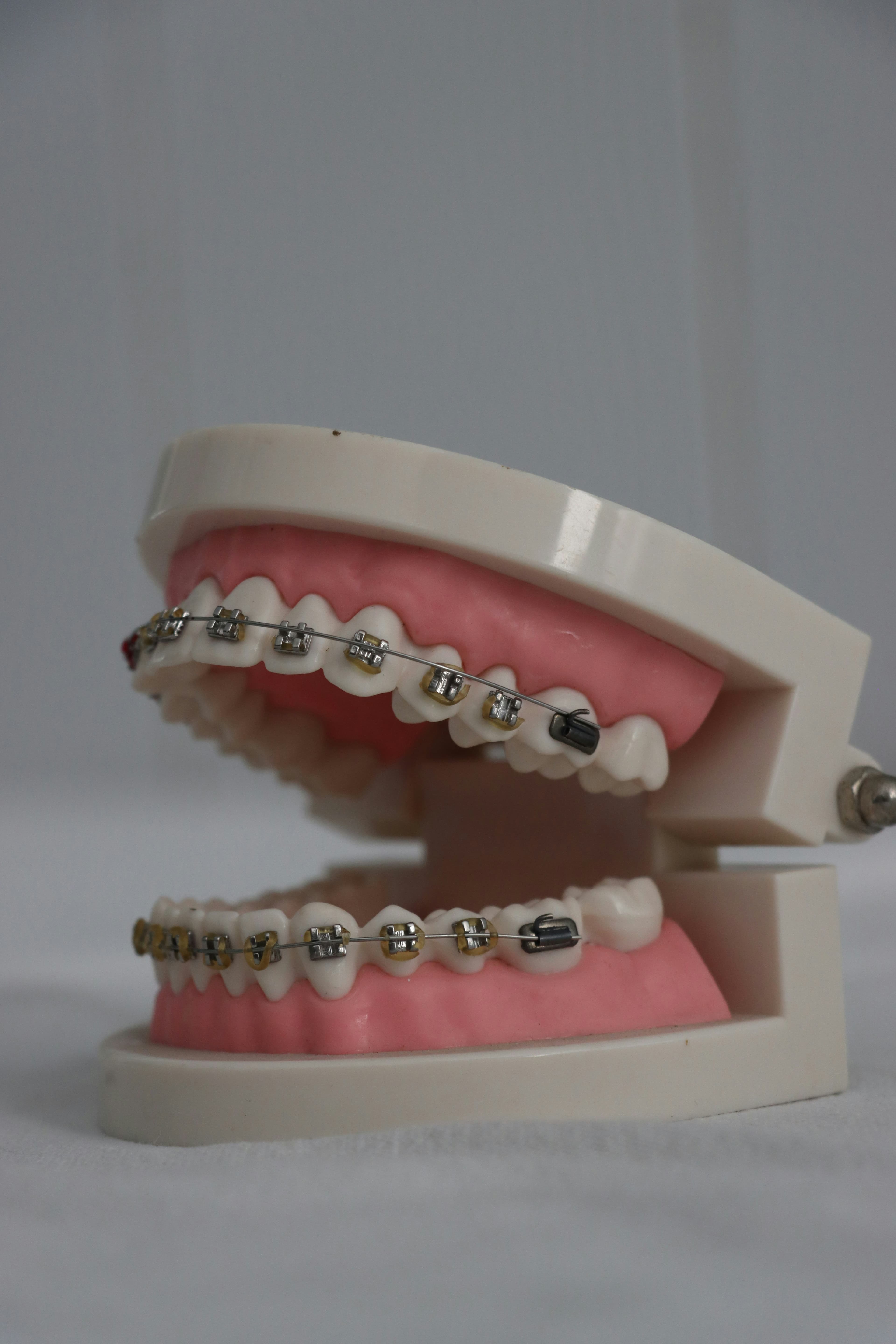 Pediatric Dentistry: Building Healthy Smiles from the Start