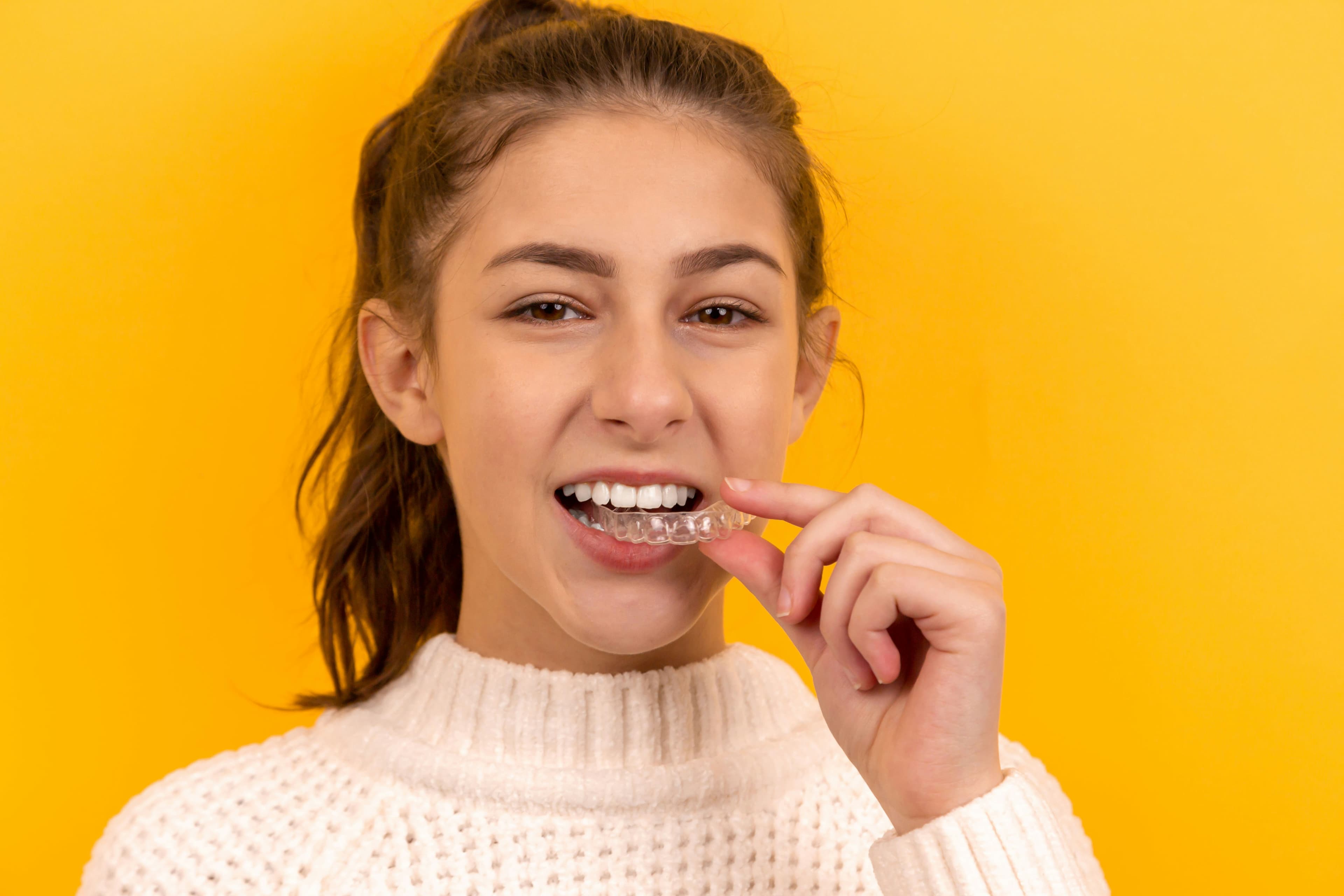 Clear Aligners: The Modern Solution for Straighter Teeth